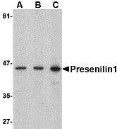 Western blot analysis of presenilin1 in human brain lysate with presenilin1 antibody at (A) 0.5, (B) 1, and (C) 2 μg/mL. Western blot analysis of presenilin1 in human brain lysate with presenilin1 antibody at (A) 0.5, (B) 1, and (C) 2 μg/mL.
