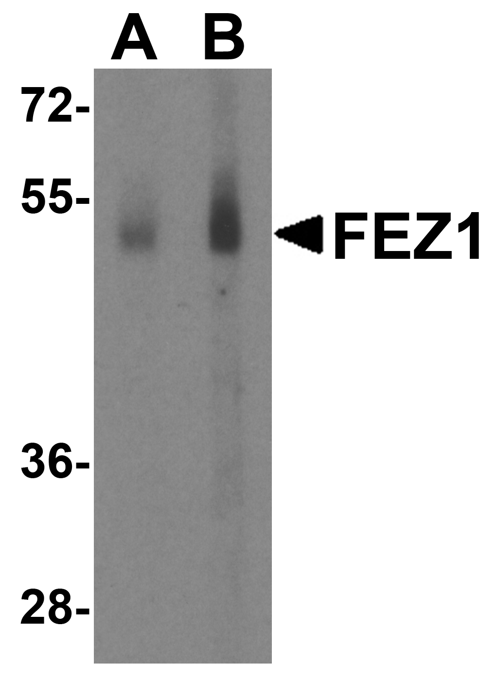 Western blot analysis of SAPAP2 in Raji cell lysate with SAPAP2 antibody at (A) 0.5 and (B) 1 μg/mL. Western blot analysis of SAPAP2 in Raji cell lysate with SAPAP2 antibody at (A) 0.5 and (B) 1 μg/mL.