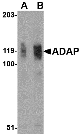 Western blot analysis of ADAP in K562 cell lysate with ADAP antibody at (A) 0.5 and (B) 1 μg/mL. Western blot analysis of ADAP in K562 cell lysate with ADAP antibody at (A) 0.5 and (B) 1 μg/mL.