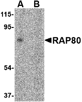 Western blot analysis of RAP80 in 293 cell lysate in (A) the absence and (B) presence of blocking peptide with RAP80 antibody at 2 μg/mL. Western blot analysis of RAP80 in 293 cell lysate in (A) the absence and (B) presence of blocking peptide with RAP80 antibody at 2 μg/mL.