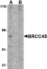 Western blot analysis of BRCC45 in HeLa cell lysate in (A) the absence and (B) presence of blocking peptide with BRCC45 antibody at 1 μg/mL. Western blot analysis of BRCC45 in HeLa cell lysate in (A) the absence and (B) presence of blocking peptide with BRCC45 antibody at 1 μg/mL.