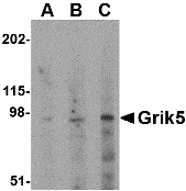 Western blot analysis of Grik5 in human brain tissue lysate with Grik5 antibody at (A) 0.5, (B) 1 and (C) 2 μg/mL. Western blot analysis of Grik5 in human brain tissue lysate with Grik5 antibody at (A) 0.5, (B) 1 and (C) 2 μg/mL.