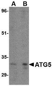 Western blot analysis of ATG5 in rat spleen tissue lysate with ATG5 antibody at (A) 1 and (B) 2 μg/mL.