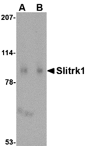 Western blot analysis of Slitrk1 in human brain tissue lysate with Slitrk1 antibody at (A) 1 and (B) 2 μg/mL. Western blot analysis of Slitrk1 in human brain tissue lysate with Slitrk1 antibody at (A) 1 and (B) 2 μg/mL.