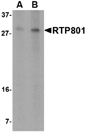 Western blot analysis of RTP801 in 293 cell lysate with RTP801 antibody at (A) 2 and (B) 4 μg/mL. Western blot analysis of RTP801 in 293 cell lysate with RTP801 antibody at (A) 2 and (B) 4 μg/mL.