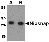 Western blot analysis of NIPSNAP in human brain tissue lysate with NIPSNAP antibody at (A) 0.5 and (B) 1 μg/mL. Western blot analysis of NIPSNAP in human brain tissue lysate with NIPSNAP antibody at (A) 0.5 and (B) 1 μg/mL.