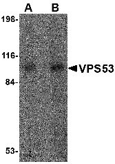 Western blot analysis of VPS53 in 293 cell lysate with VPS53 antibody at (A) 0.5 and (B) 1 μg/mL. Western blot analysis of VPS53 in 293 cell lysate with VPS53 antibody at (A) 0.5 and (B) 1 μg/mL.