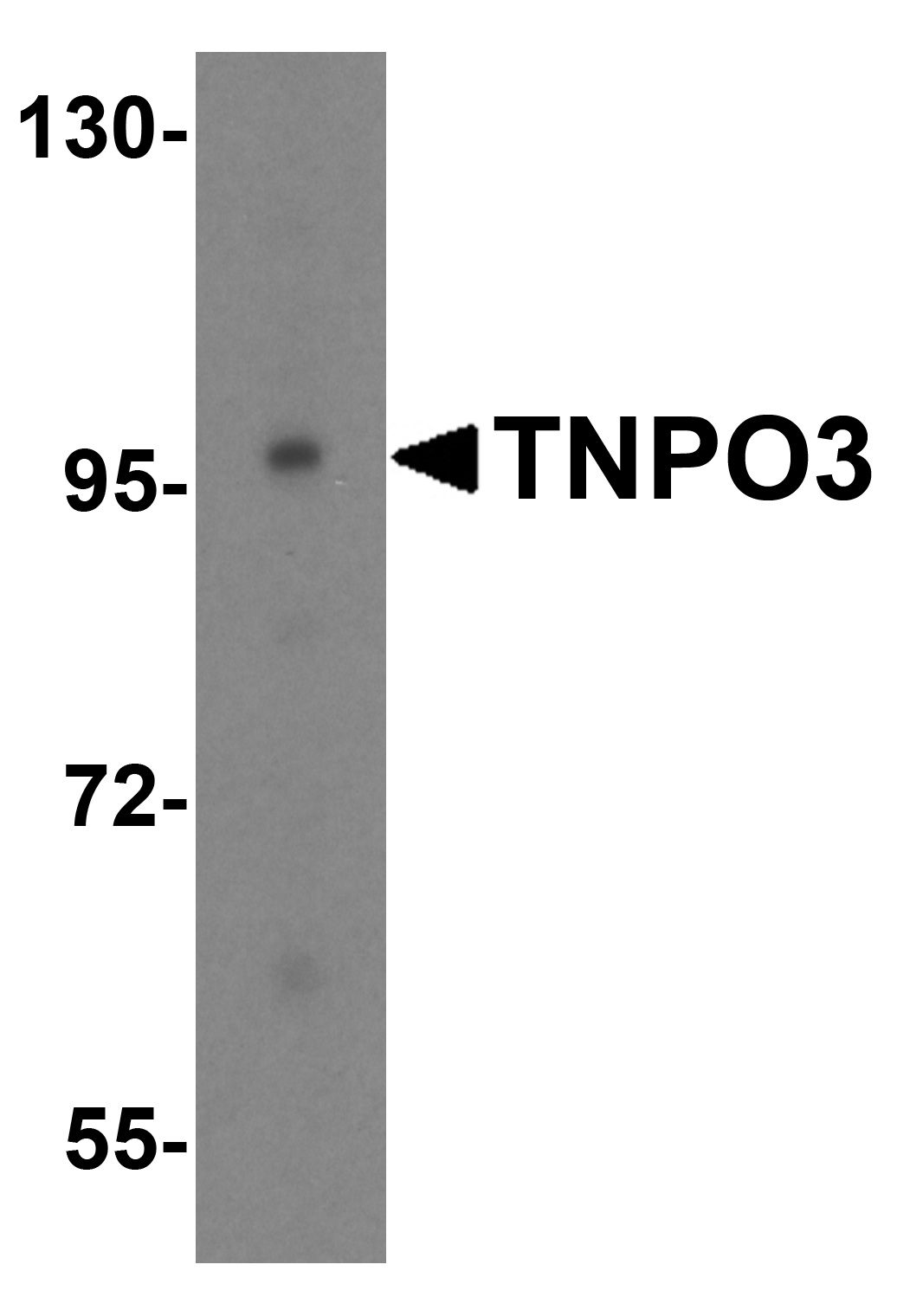 Western blot analysis of TNPO3 in HeLa cell lysate with TNPO3 antibody at 0.5 μg/mL. Western blot analysis of TNPO3 in HeLa cell lysate with TNPO3 antibody at 0.5 μg/mL.