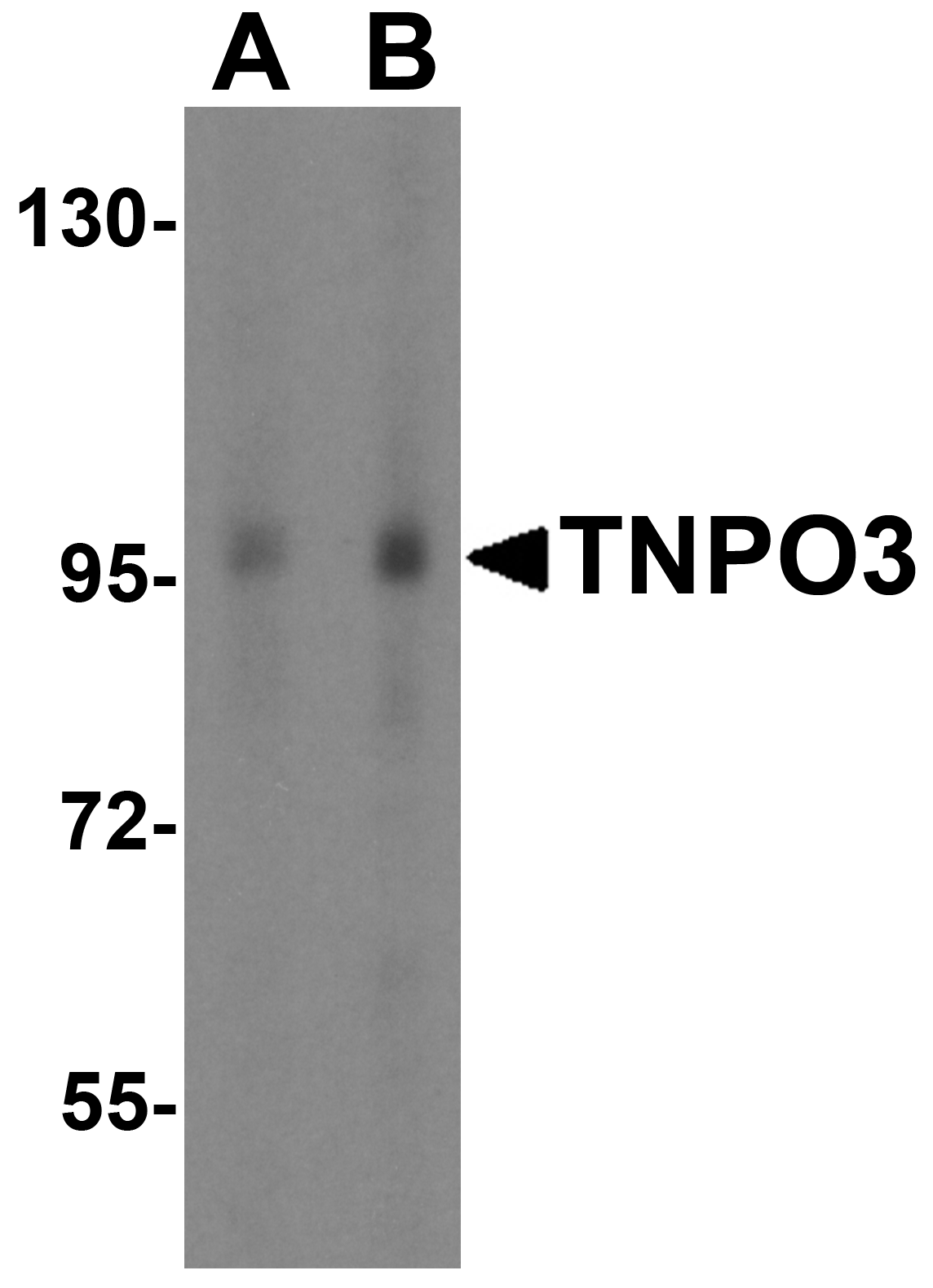 Western blot analysis of TNPO3 expression in Jurkat cell lysate with TNPO3 antibody at (A) 1 and (B) 2 μg/ml. Western blot analysis of TNPO3 expression in Jurkat cell lysate with TNPO3 antibody at (A) 1 and (B) 2 μg/ml.