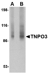 Western blot analysis of TNPO3 in rat liver tissue lysate with TNPO3 antibody at (A) 1 and (B) 2 μg/mL. Western blot analysis of TNPO3 in rat liver tissue lysate with TNPO3 antibody at (A) 1 and (B) 2 μg/mL.