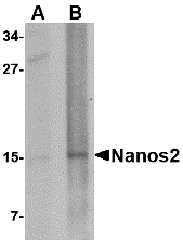 Western blot analysis of Nanos2 in rat brain tissue lysate with Nanos2 antibody at (A) 1 and (B) 2 μg/mL. Western blot analysis of Nanos2 in rat brain tissue lysate with Nanos2 antibody at (A) 1 and (B) 2 μg/mL.