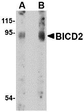 Western blot analysis of BICD2 in A549 cell lysate with BICD2 antibody at (A) 1 and (B) 2 μg/mL. Western blot analysis of BICD2 in A549 cell lysate with BICD2 antibody at (A) 1 and (B) 2 μg/mL.