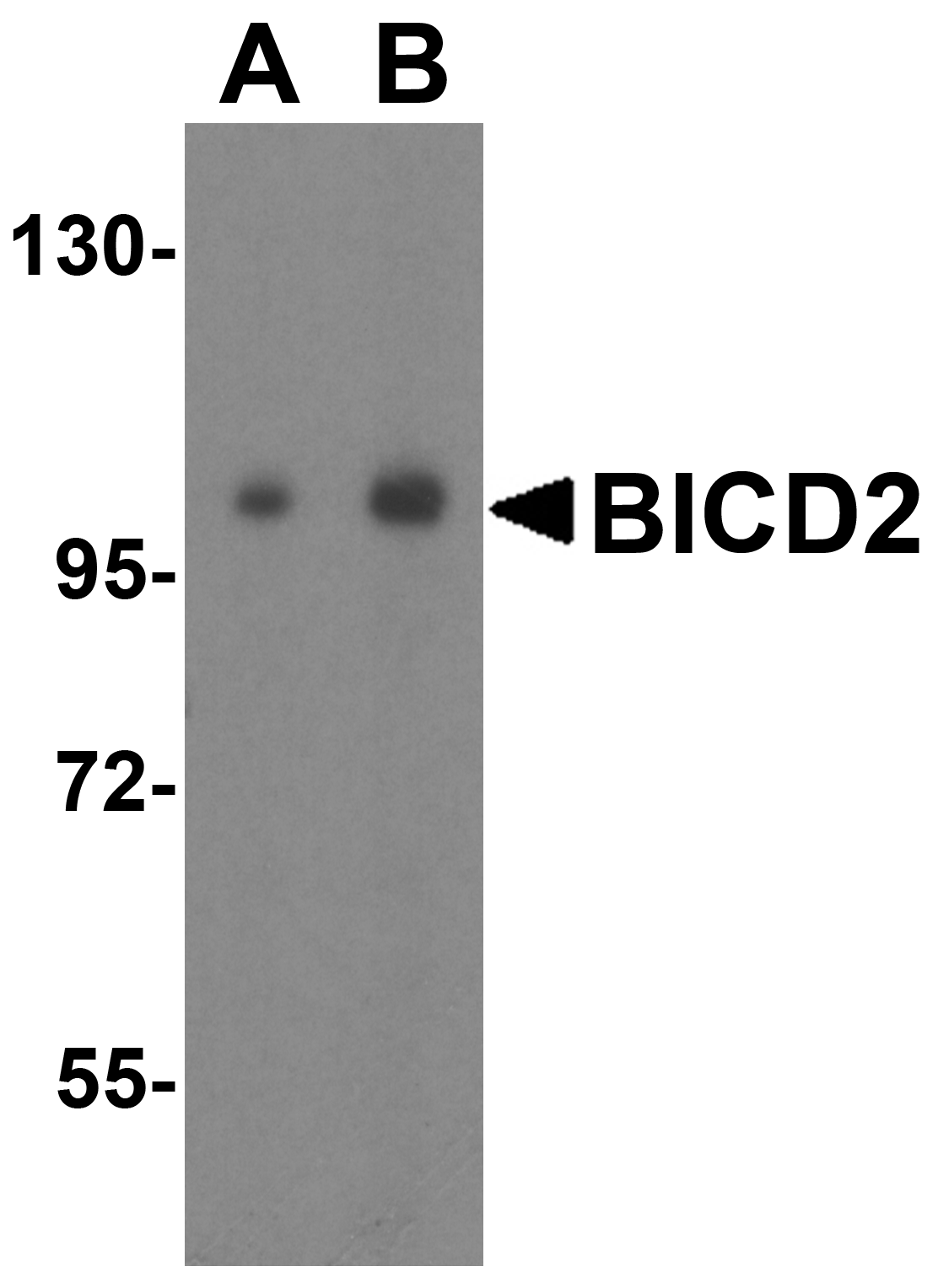 Western blot analysis of BICD2 in 293 cell lysate with BICD2 antibody at (A) 1 and (B) 2 μg/mL. Western blot analysis of BICD2 in 293 cell lysate with BICD2 antibody at (A) 1 and (B) 2 μg/mL.