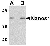 Western blot analysis of Nanos1 in rat brain tissue lysate with Nanos1 antibody at (A) 1 and (B) 2 μg/mL. Western blot analysis of Nanos1 in rat brain tissue lysate with Nanos1 antibody at (A) 1 and (B) 2 μg/mL.