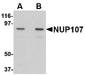 Western blot analysis of NUP107 in A549 cell lysate with NUP107 antibody at (A) 1 and (B) 2 μg/mL. Western blot analysis of NUP107 in A549 cell lysate with NUP107 antibody at (A) 1 and (B) 2 μg/mL.