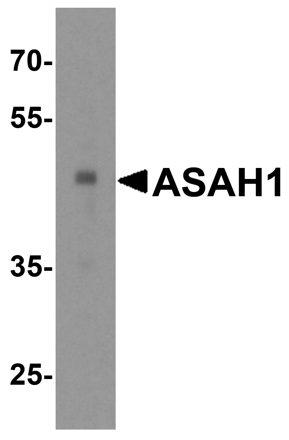 Western blot analysis of ASAH1 in human heart tissue lysate with ASAH1 antibody at 1 μg/mL. Western blot analysis of ASAH1 in human heart tissue lysate with ASAH1 antibody at 1 μg/mL.