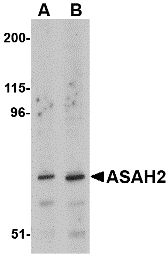 Western blot analysis of ASAH2 in 293 cell lysate with ASAH2 antibody at (A) 1 and (B) 2 μg/mL. Western blot analysis of ASAH2 in 293 cell lysate with ASAH2 antibody at (A) 1 and (B) 2 μg/mL.