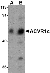 Western blot analysis of ACVR1C in human placenta tissue lysate with ACVR1C antibody at (A) 1 and (B) 2 μg/mL. Western blot analysis of ACVR1C in human placenta tissue lysate with ACVR1C antibody at (A) 1 and (B) 2 μg/mL.