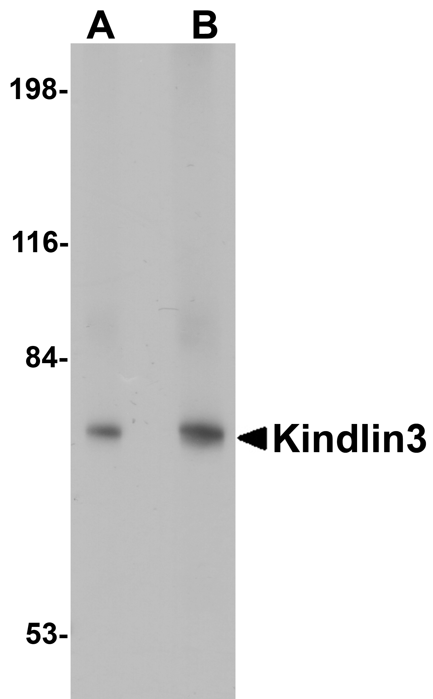 Western blot analysis of KINDLIN3 in rat spleen lysate with KINDLIN3 antibody at (A) 1 and (B) 2 μg/mL. Western blot analysis of KINDLIN3 in rat spleen lysate with KINDLIN3 antibody at (A) 1 and (B) 2 μg/mL.