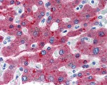 Human liver tissue stained with Factor H Antibody at 20 μg/mL followed by biotinylated anti-mouse IgG secondary antibody, alkaline phosphatase-streptavidin and chromogen. Human liver tissue stained with Factor H Antibody at 20 μg/mL followed by biotinylated anti-mouse IgG secondary antibody, alkaline phosphatase-streptavidin and chromogen.