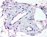 Immunohistochemistry staining of ADAMTS1 in testis, vessels tissue using ADAMTS1 Antibody. Immunohistochemistry staining of ADAMTS1 in testis, vessels tissue using ADAMTS1 Antibody.