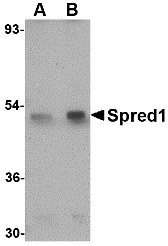 Western blot analysis of Spred1 in mouse brain tissue lysate with Spred1 antibody at (A) 1 and (B) 2 μg/mL. Western blot analysis of Spred1 in mouse brain tissue lysate with Spred1 antibody at (A) 1 and (B) 2 μg/mL.