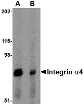 Western blot analysis of Integrin alpha 4 in rat spleen tissue lysate with Integrin alpha 4 antibody at 1 μg/mL in (A) the absence and (B) the presence of blocking peptide. Western blot analysis of Integrin alpha 4 in rat spleen tissue lysate with Integrin alpha 4 antibody at 1 μg/mL in (A) the absence and (B) the presence of blocking peptide.