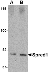 Western blot analysis of Spred1 in human brain tissue lysate with Spred1 antibody at (A) 1 and (B) 2 μg/mL. Western blot analysis of Spred1 in human brain tissue lysate with Spred1 antibody at (A) 1 and (B) 2 μg/mL.