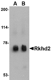 Western blot analysis of Rkhd2 in rat heart tissue lysate with Rkhd2 antibody at (A) 0.5 μg/mL and (B) 1 μg/mL. Western blot analysis of Rkhd2 in rat heart tissue lysate with Rkhd2 antibody at (A) 0.5 μg/mL and (B) 1 μg/mL.