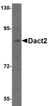 Western blot analysis of Dact2 in SK-N-SH cell lysate with Dact2 antibody at 1 μg/mL. Western blot analysis of Dact2 in SK-N-SH cell lysate with Dact2 antibody at 1 μg/mL.