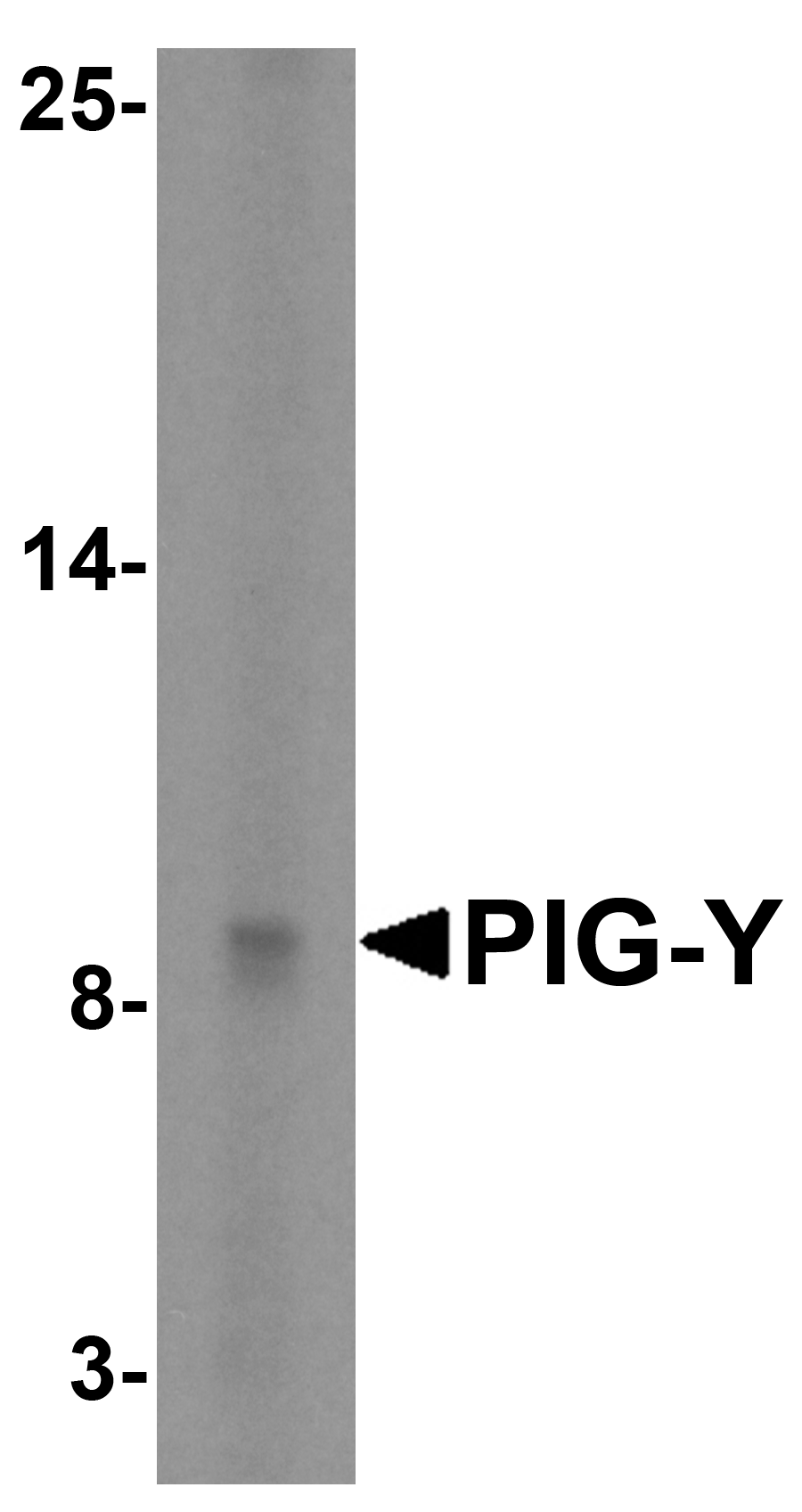 Western blot analysis of PIG-Y in human skeletal muscle tissue lysate with PIG-Y antibody at 5 μg/mL. Western blot analysis of PIG-Y in human skeletal muscle tissue lysate with PIG-Y antibody at 5 μg/mL.
