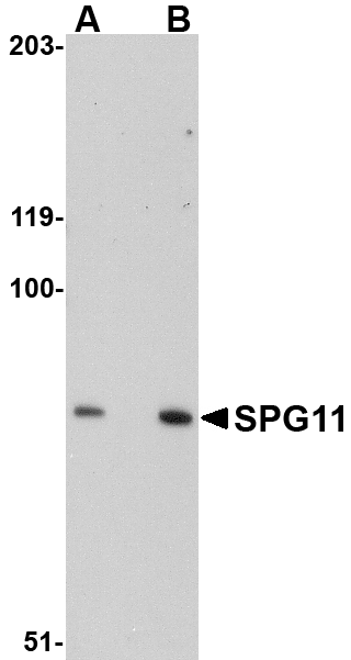 Western blot analysis of SPG11 in mouse heart tissue lysate with SPG11 antibody at (A) 0.5 and (B) 1 μg/mL.