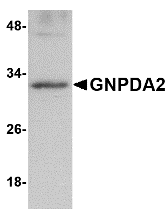 Western blot analysis of GNPDA2 in human kidney lysate with GNPDA2 antibody at 1 μg/mL. Western blot analysis of GNPDA2 in human kidney lysate with GNPDA2 antibody at 1 μg/mL.