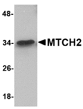 Western blot analysis of MTCH2 in 293 cell lysate with MTCH2 antibody at 1 μg/mL. Western blot analysis of MTCH2 in 293 cell lysate with MTCH2 antibody at 1 μg/mL.