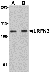 Western blot analysis of LRFN3 in K562 lysate with LRFN3 antibody at (A) 1 and (B) 2 μg/mL. Western blot analysis of LRFN3 in K562 lysate with LRFN3 antibody at (A) 1 and (B) 2 μg/mL.