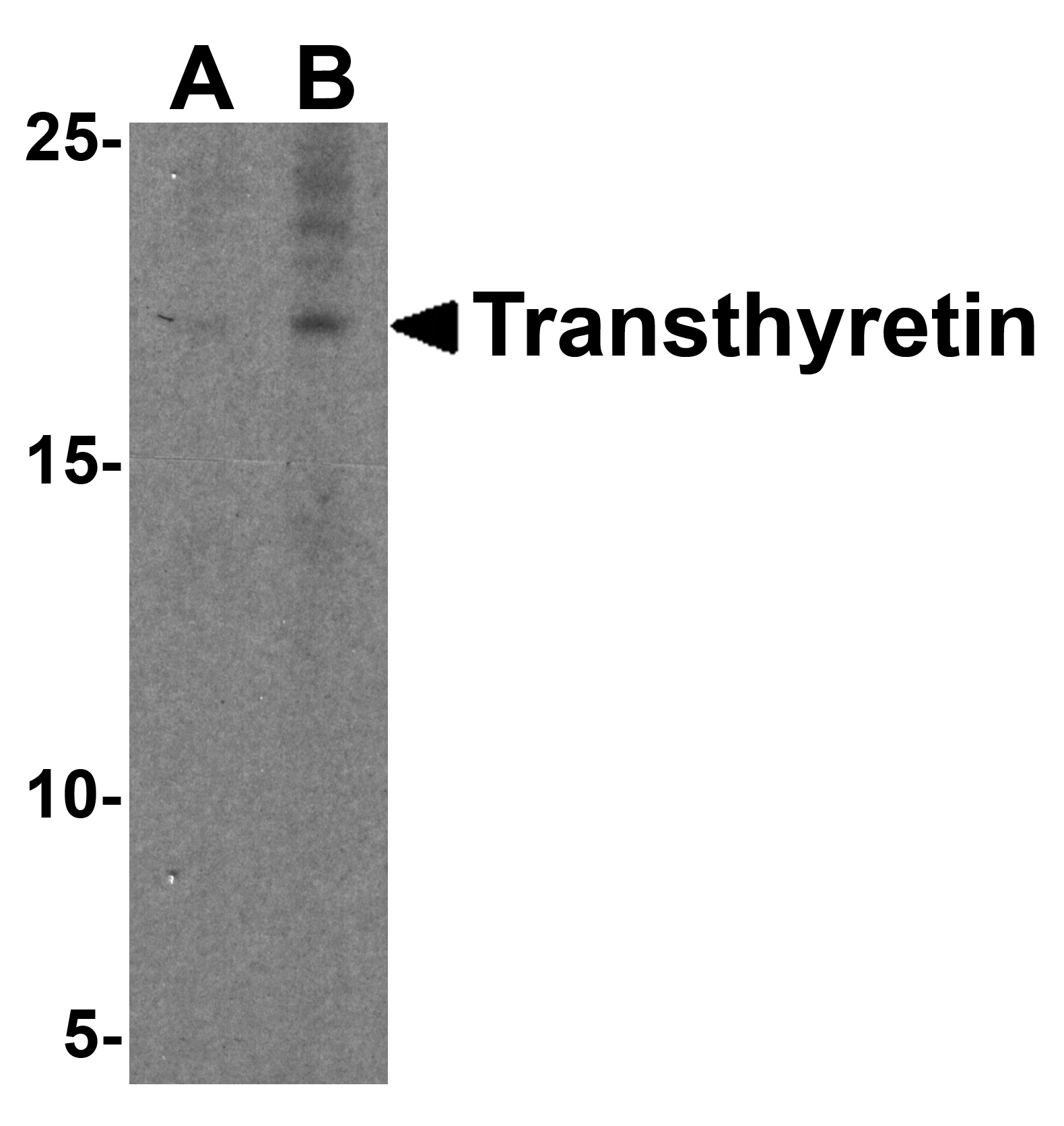 Western blot analysis of Transthyretin in HepG2 cell lysate with Transthyretin antibody at (A) 1 and (B) 2 μg/mL. Western blot analysis of Transthyretin in HepG2 cell lysate with Transthyretin antibody at (A) 1 and (B) 2 μg/mL.