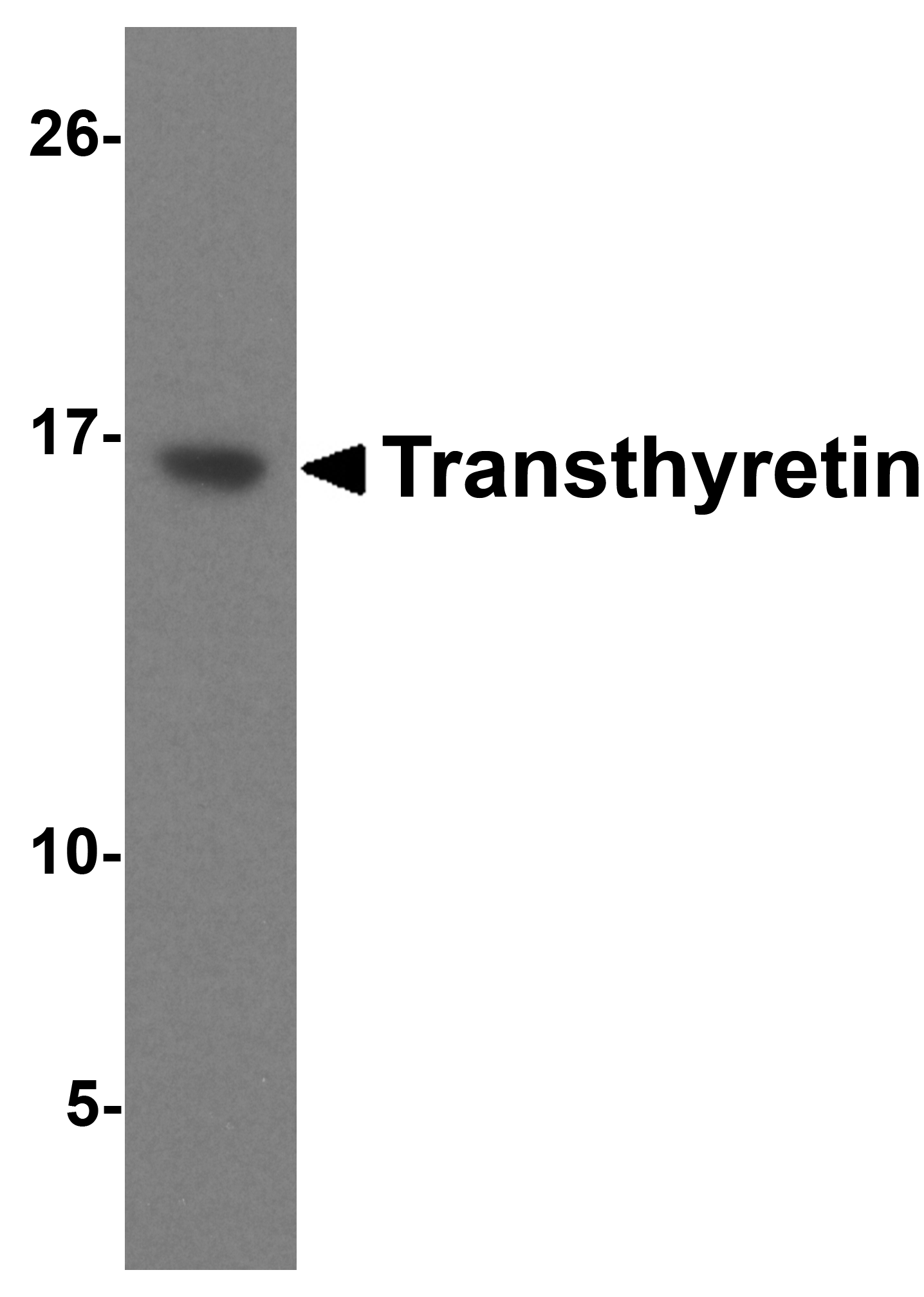 Western blot analysis of 125 ng of Transthyretin recombinant protein with Transthyretin antibody at 1 μg/mL. Western blot analysis of 125 ng of Transthyretin recombinant protein with Transthyretin antibody at 1 μg/mL.