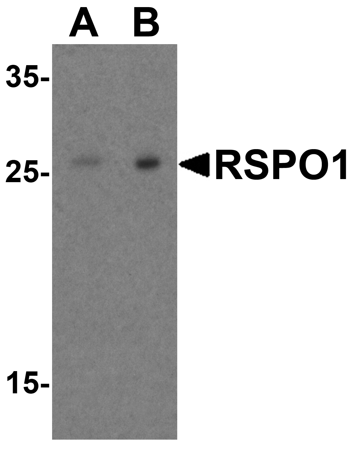 <strong>Figure 4 Western Blot Validation in Human Heart</strong><br>
Loading: 15 μg of lysates per lane.
Antibodies: RSPO1, 5171 (A: 1 μg/mL, B: 2 μg/mL), 1h incubation at RT in 5% NFDM/TBST.
Secondary: Goat anti-rabbit IgG HRP conjugate at 1:10000 dilution. <strong>Figure 4 Western Blot Validation in Human Heart</strong><br>
Loading: 15 μg of lysates per lane.
Antibodies: RSPO1, 5171 (A: 1 μg/mL, B: 2 μg/mL), 1h incubation at RT in 5% NFDM/TBST.
Secondary: Goat anti-rabbit IgG HRP conjugate at 1:10000 dilution.