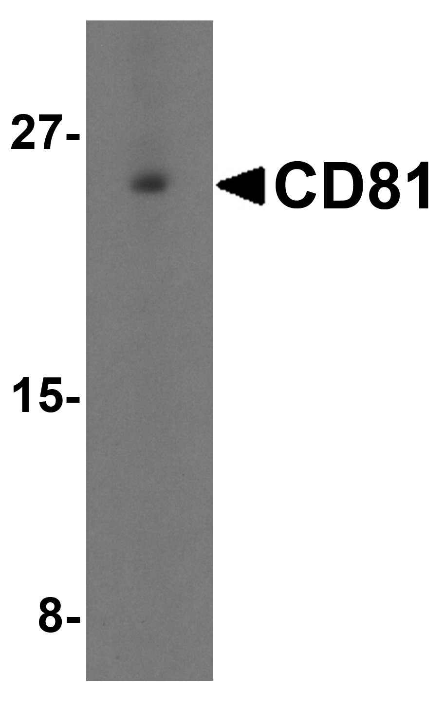 Western blot analysis of CD81 in human lung tissue lysate with CD81 antibody at 1 μg/mL in (A) the absence and (B) the presence of blocking petide. Western blot analysis of CD81 in human lung tissue lysate with CD81 antibody at 1 μg/mL in (A) the absence and (B) the presence of blocking petide.