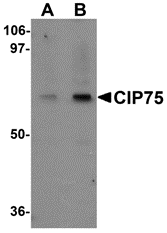 Western blot analysis of CIP75 in 3T3 cell lysate with CIP75 antibody at (A) 1 and (B) 2 μg/mL. Western blot analysis of CIP75 in 3T3 cell lysate with CIP75 antibody at (A) 1 and (B) 2 μg/mL.