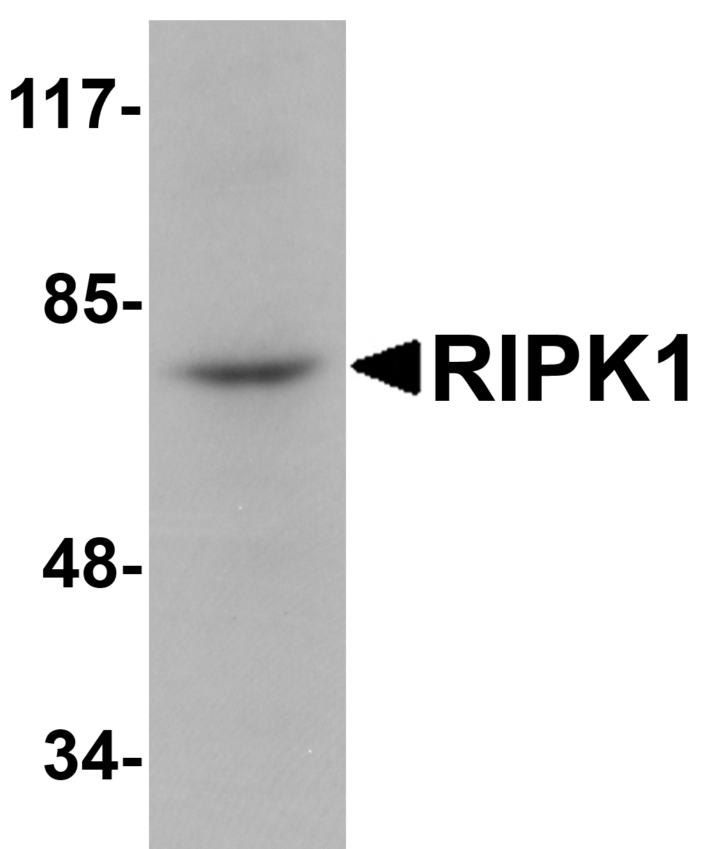 Western blot analysis of RIPK1 in rat kidney tissue lysate with RIPK1 antibody at 1 μg/mL. Western blot analysis of RIPK1 in rat kidney tissue lysate with RIPK1 antibody at 1 μg/mL.