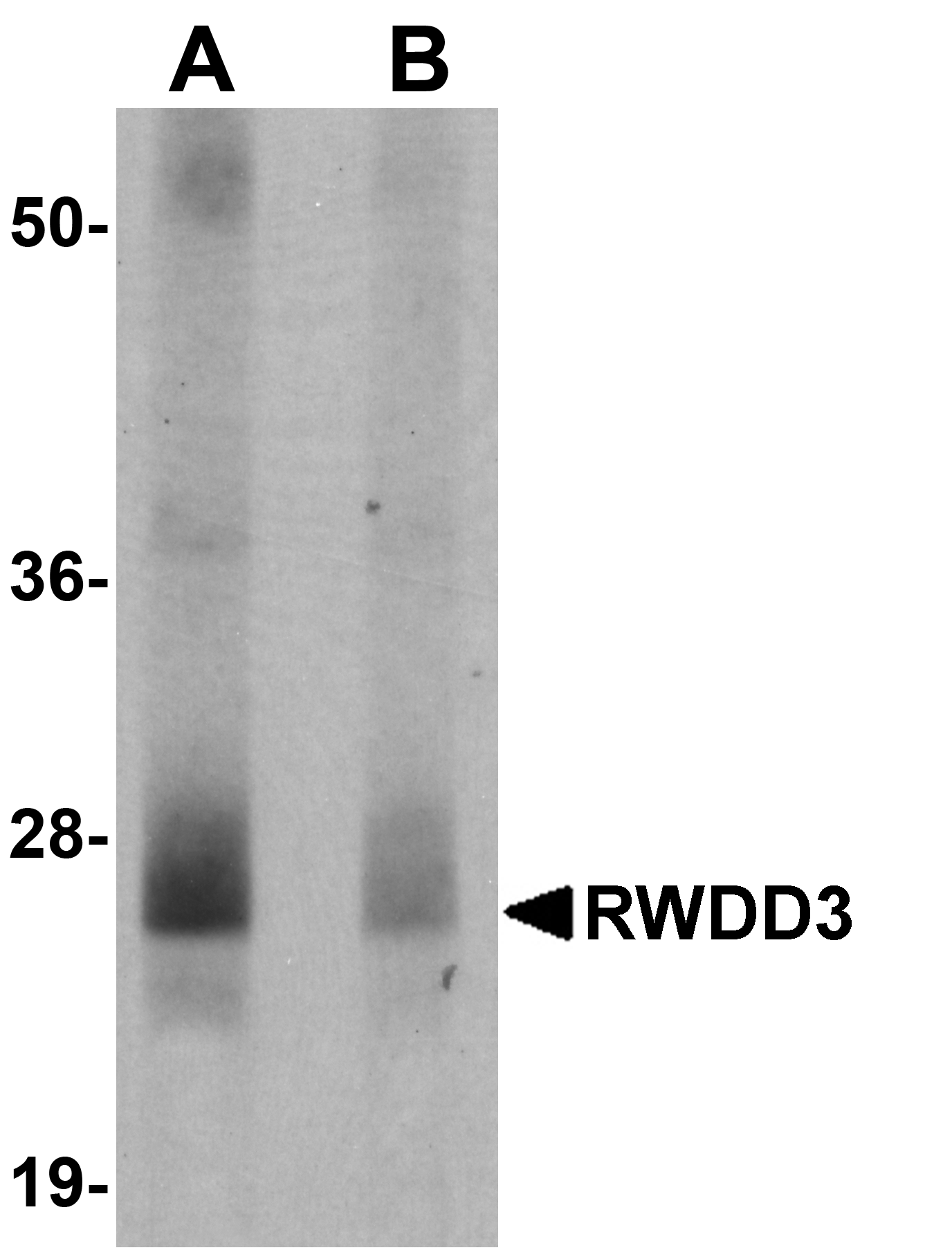 Western blot analysis of RWDD3 in mouse kidney tissue lysate with RWDD3 antibody at 0.5 μg/mL in (A) the absence and (B) the presence of blocking peptide. Western blot analysis of RWDD3 in mouse kidney tissue lysate with RWDD3 antibody at 0.5 μg/mL in (A) the absence and (B) the presence of blocking peptide.