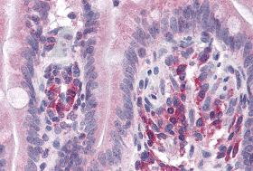 Immunohistochemistry of VARP in human small intestine with VARP antibody at 5 μg/mL. Immunohistochemistry of VARP in human small intestine with VARP antibody at 5 μg/mL.