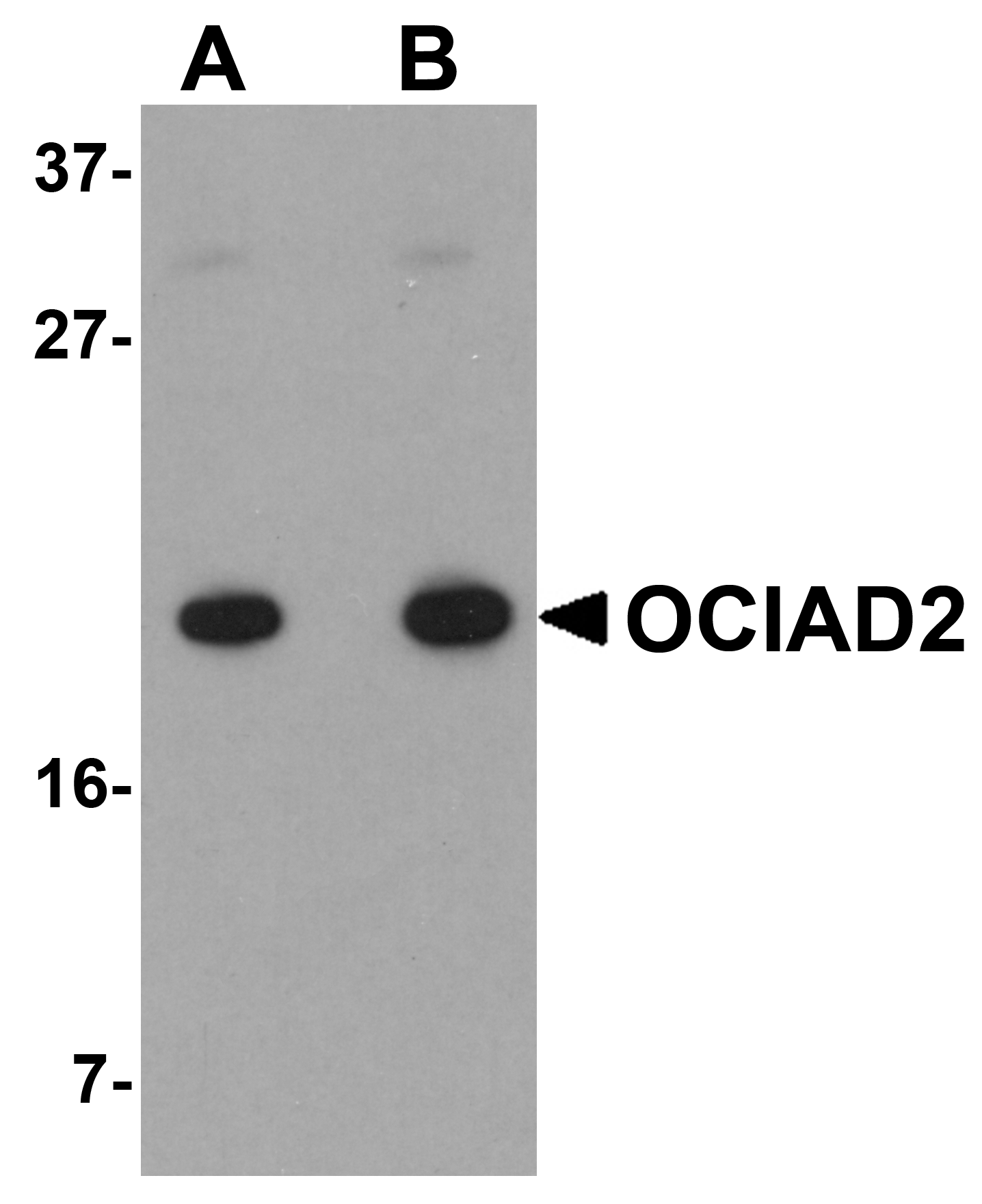 Western blot analysis of OCIAD2 in A549 cell lysate with OCIAD2 antibody at (A) 0.5 and (B) 1 μg/mL. Western blot analysis of OCIAD2 in A549 cell lysate with OCIAD2 antibody at (A) 0.5 and (B) 1 μg/mL.