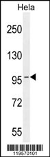 Western blot analysis in Hela cell line lysates (35ug/lane). Western blot analysis in Hela cell line lysates (35ug/lane).