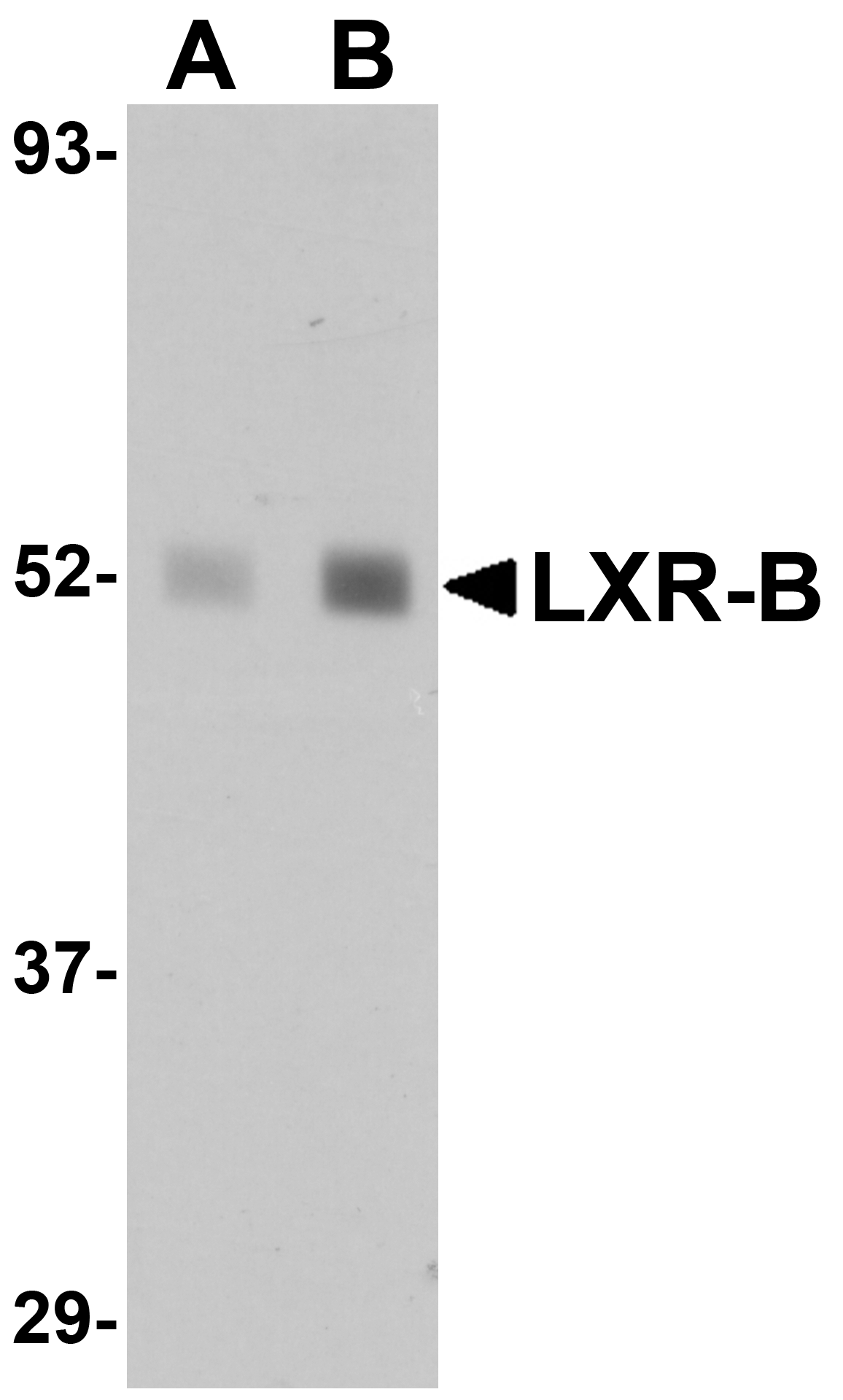 Western blot analysis of LXR-B in human lung tissue lysate with LXR-B antibody at (A) 1 and (B) 2 μg/mL. Western blot analysis of LXR-B in human lung tissue lysate with LXR-B antibody at (A) 1 and (B) 2 μg/mL.