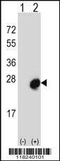 Western blot analysis of MID1IP1 using rabbit polyclonal MID1IP1 Antibody using 293 cell lysates (2 ug/lane) either nontransfected (Lane 1) or transiently transfected (Lane 2) with the MID1IP1 gene. Western blot analysis of MID1IP1 using rabbit polyclonal MID1IP1 Antibody using 293 cell lysates (2 ug/lane) either nontransfected (Lane 1) or transiently transfected (Lane 2) with the MID1IP1 gene.