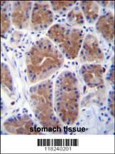 MID1IP1 Antibody immunohistochemistry analysis in formalin fixed and paraffin embedded human stomach tissue followed by peroxidase conjugation of the secondary antibody and DAB staining. MID1IP1 Antibody immunohistochemistry analysis in formalin fixed and paraffin embedded human stomach tissue followed by peroxidase conjugation of the secondary antibody and DAB staining.