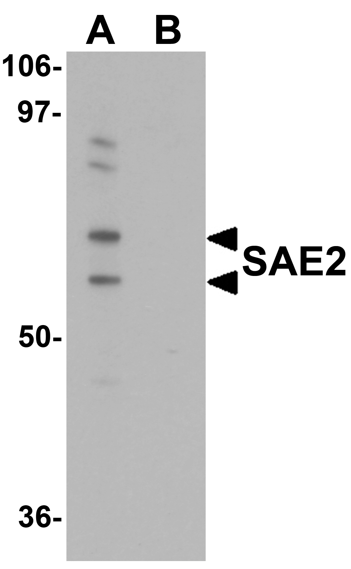 Western blot analysis of SAE2 in 293 cell lysate with SAE2 antibody at 0.25 μg/mL in (A) the absence and (B) the presence of blocking peptide. Western blot analysis of SAE2 in 293 cell lysate with SAE2 antibody at 0.25 μg/mL in (A) the absence and (B) the presence of blocking peptide.