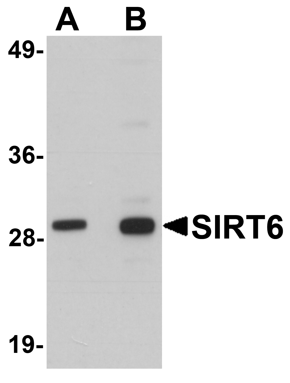 Western blot analysis of SIRT6 in HeLa cell lysate with SIRT6 antibody at (A) 0.5 and (B) 1 μg/mL. Western blot analysis of SIRT6 in HeLa cell lysate with SIRT6 antibody at (A) 0.5 and (B) 1 μg/mL.